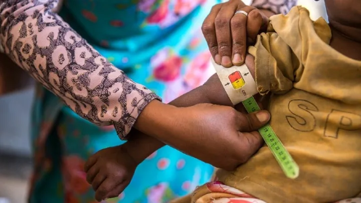 Malnutrition Treatment